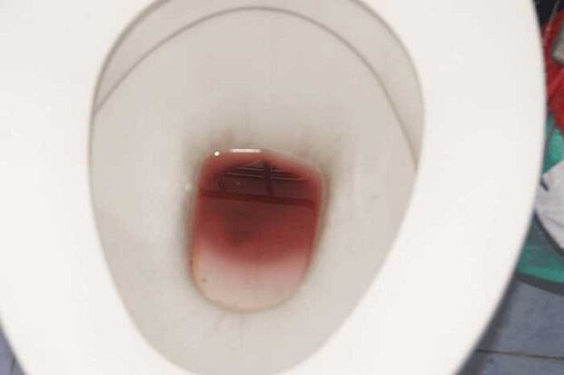 spotting hos män när de är upphetsade